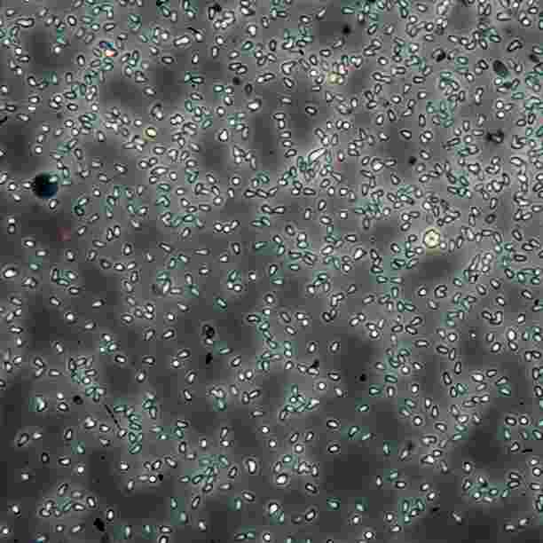 Il clima influisce sulla trasmissione delle malattie